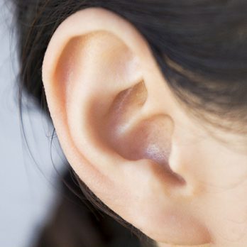 Redução das orelhas - Contorno Facial - Cirurgia Estética - Dr. Fernando Rodrigues - Cirurgião Plástico BH