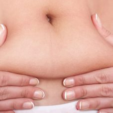 Entenda como a abdominoplastia elimina o excesso de pele na barriga