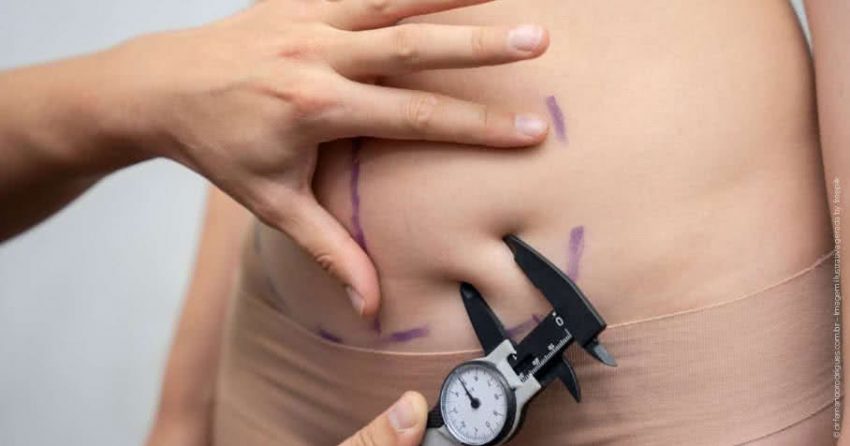 O que você pode esperar de verdade ao fazer uma cirurgia plástica?