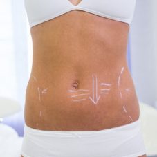 Quais são as combinações de cirurgias estéticas mais populares?