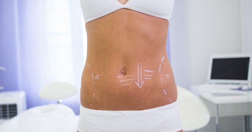 Quais são as combinações de cirurgias estéticas mais populares?