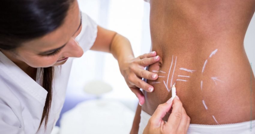 Cirurgia plástica e novos ciclos: por que planejar é o melhor começo de 2026