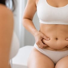 Flacidez abdominal e lipoaspiração o que a lipo pode e não pode tratar