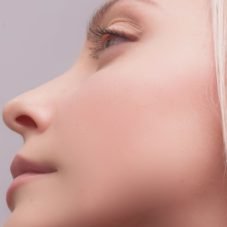 Rinoplastia funcional e estética diferenças, avaliação e o que cada uma resolve